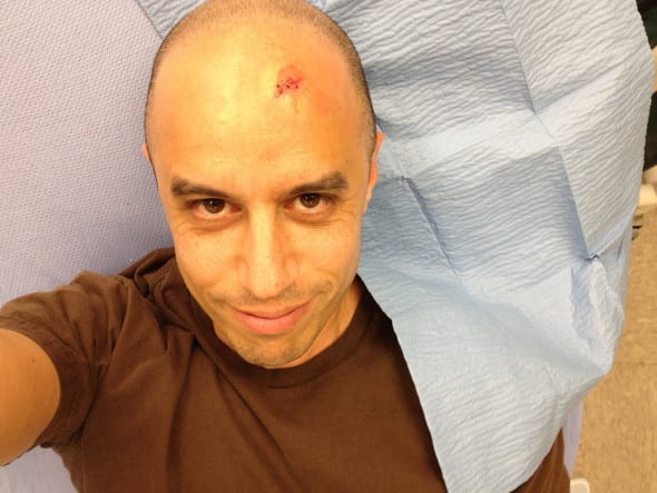 zdoggmd gets stitches